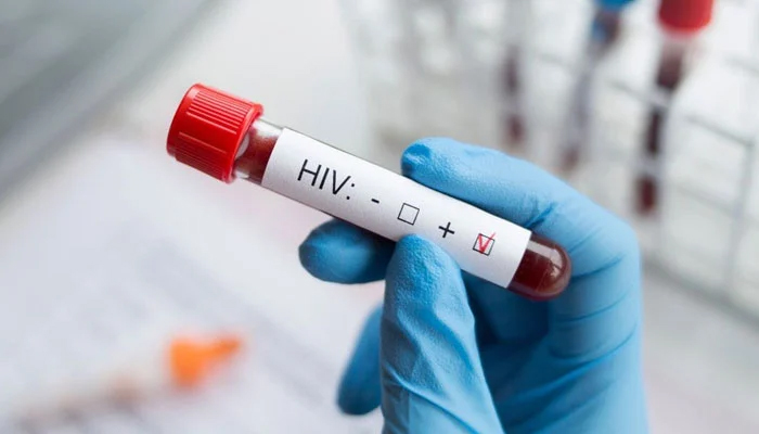 پاکستان میں 15 ماہ کے دوران 2 ہزار سے زائد بچوں میں ایچ آئی وی کی تشخیص، سندھ سب سے زیادہ متاثر