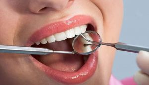 مسوڑھوں سے خون آنا گردوں کی بیماری کی ابتدائی علامت ہو سکتا ہے، نئی تحقیق